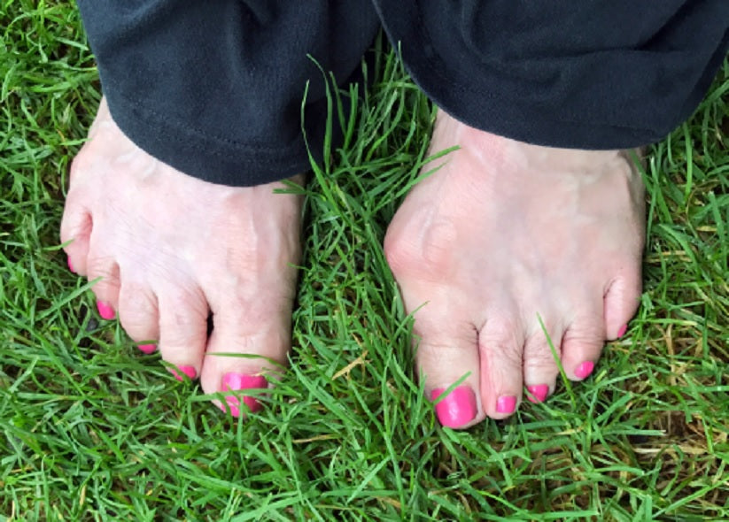 Crooked Toes And How To Correct Them